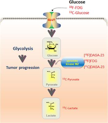 Imaging glucose metabolism to reveal tumor progression